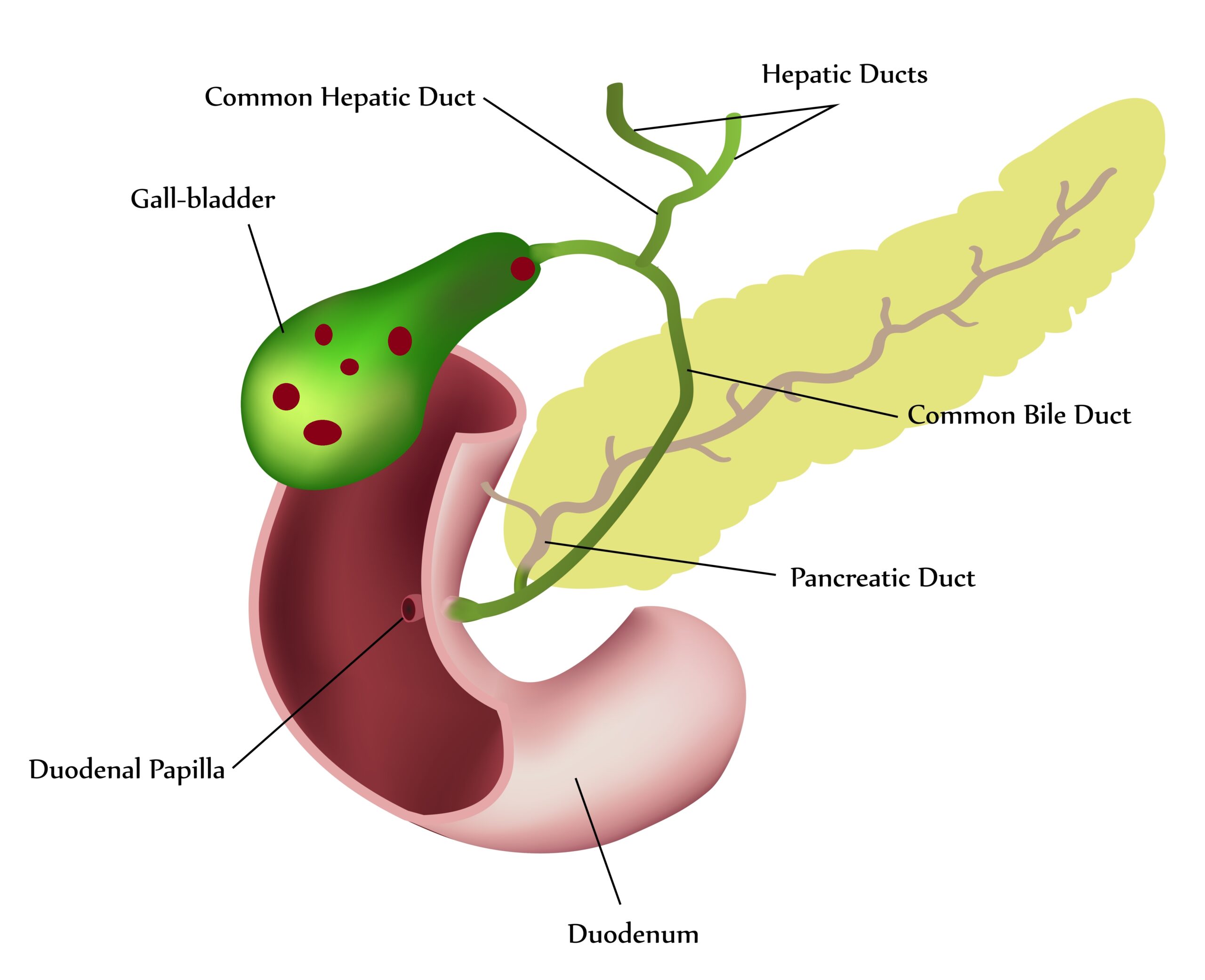 Gallbladder Stones Do I Need Surgery Welcome To Baliga Diagnostics